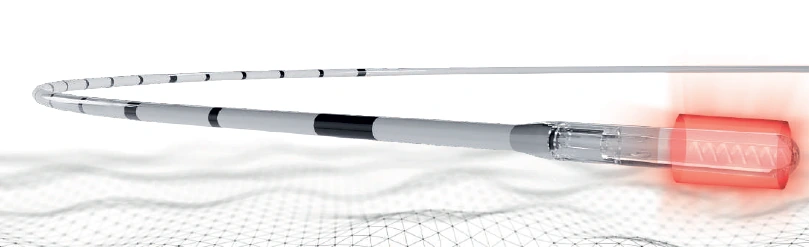 CORONA Infinite Ring Fistula Probe